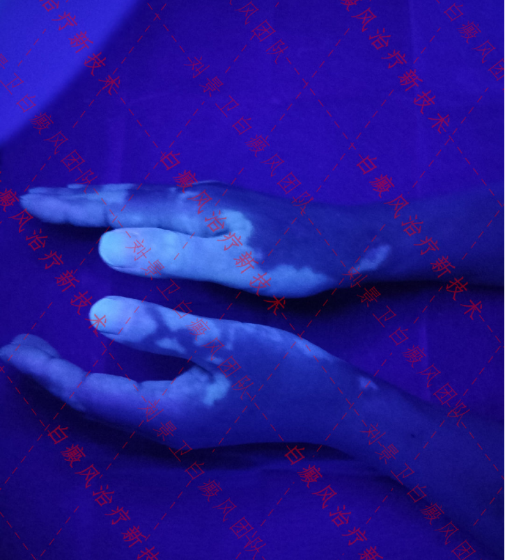1639455187295576.png
