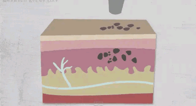 洗纹身原理-7动图.gif