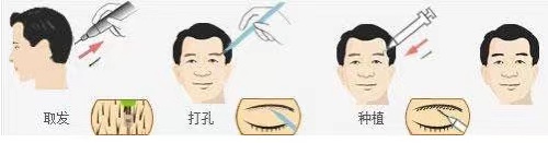 植眉选图3.jpg