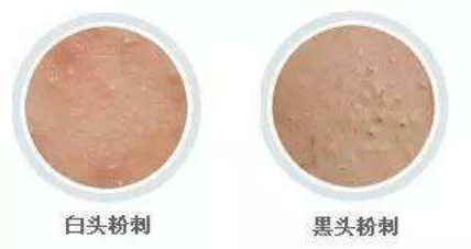 é­å£,ææ¥æ¶ç­ä½ è¿ä¸ªç£¨äººçå°å¦ç²¾