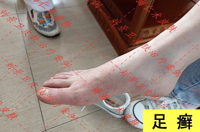 足藓.jpg