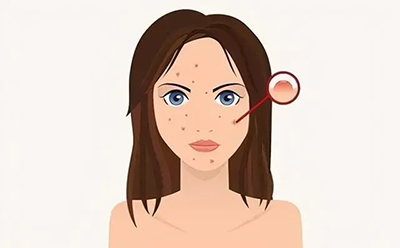 a35a011e7bb756f577c18f68ef56e94.png