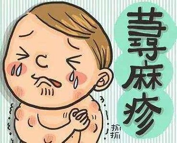 荨麻疹1.JPEG