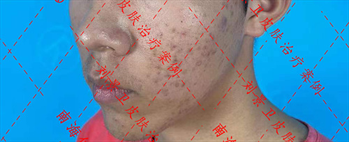 b3490afd93adda32a27881e92c6e5b5.jpg