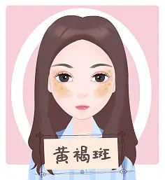 黄褐斑1.webp.jpg