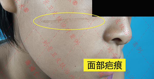 海口仁术皮肤.jpg