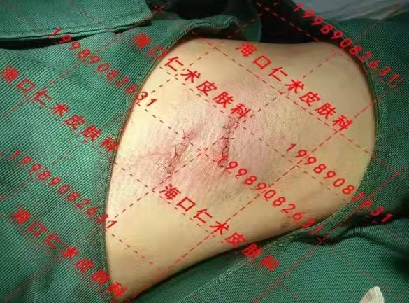 海口仁术皮肤.jpg