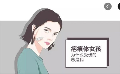 疤1.jpg