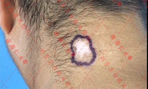 5db06c2f06a212f316e99da3406f66c.png