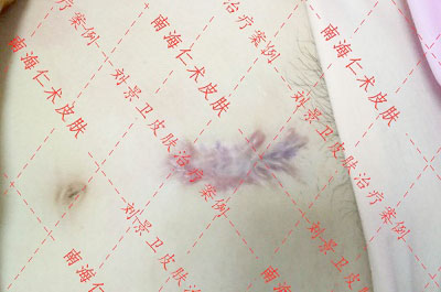 海口仁术皮肤.jpg