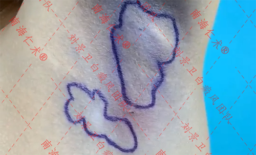 海口仁术皮肤.png