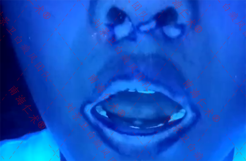 4b39d039f25ebfdcb9b627cd66a528d.png