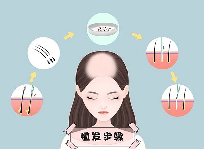 发1.jpg