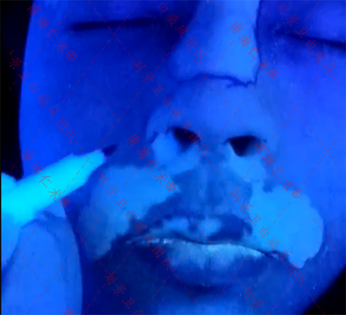 988b737679a8f13af82d0cdfdb9ef4a.png