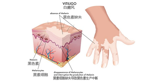 a45f0f38f42d1243798c8e7aacbe265.png