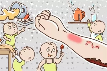 烫伤疤痕.jpg