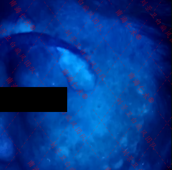 海口仁术白癜风.png