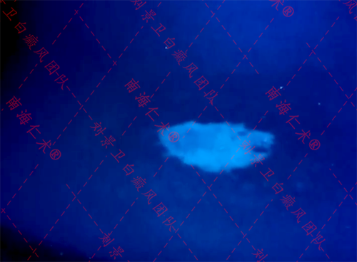 海口仁术白癜风.png