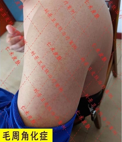 微信截图_20240218104642.png
