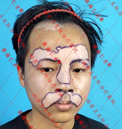脸上.jpg