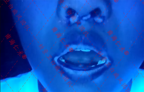 海口仁术白癜风.png