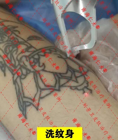 小腿纹身.jpg