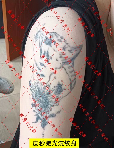 手臂纹身.jpg