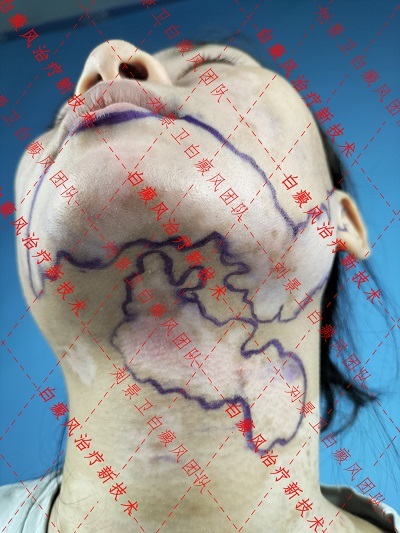 女下巴.jpg