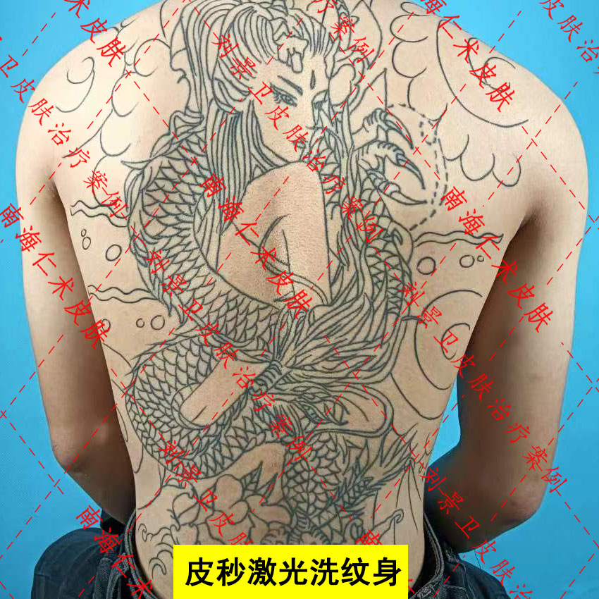 洗纹身满背.jpg