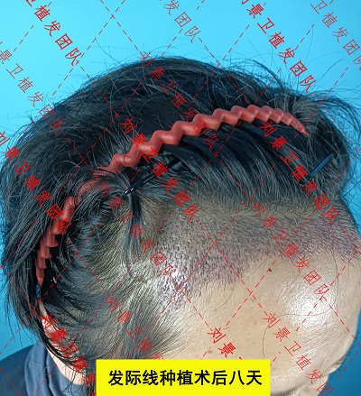 发际8.1.jpg