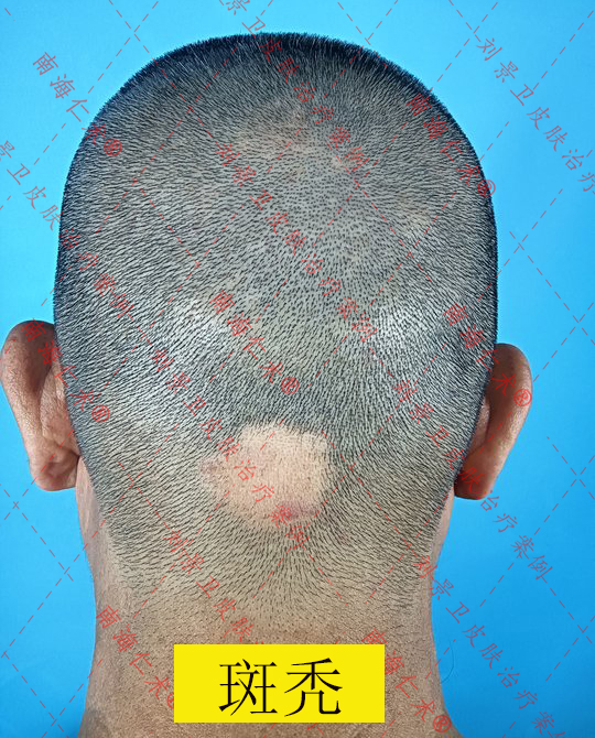 aa931efb02c37ec517cc0dea4e2692b9.jpg