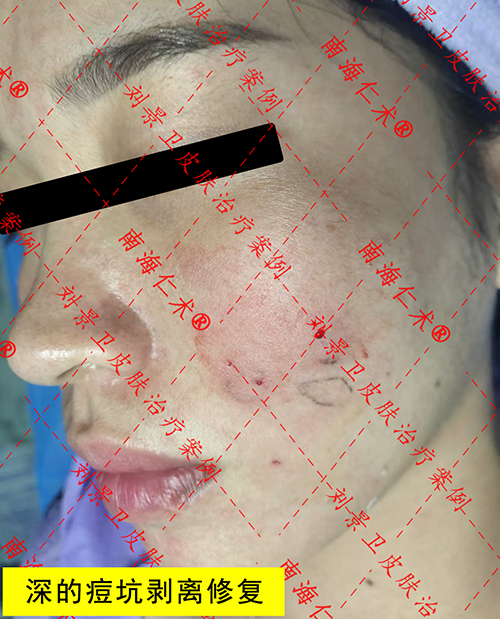 6cc2ec777aaa6ed416f4f8feea60fab.jpg