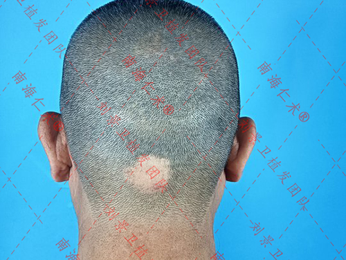 lQDPJxDkfuYQ433NEEDNDDCwEFGeI-OLMN8GT1he5T2bAA_3120_4160.jpg_720x720q90.jpg