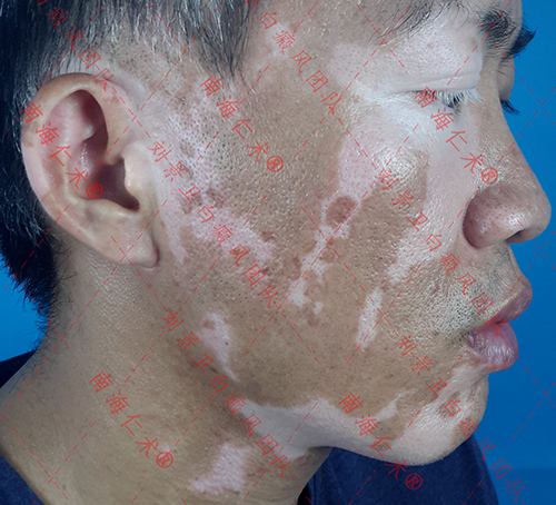 mmexport1616647624533.jpg