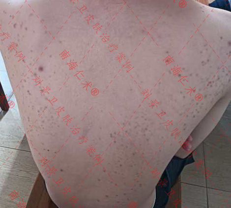 iwEdAqNqcGcDAQTRA8AF0QUABrBrmWRl-PFV-Qa_UbVX01sAB9MAAAAAoPg_BggACaJpbQoAC9IAATdT.jpg_720x720q90.jpg