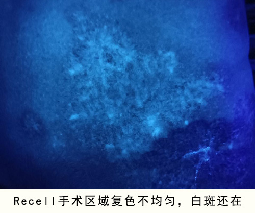 lQDPJwWQHdSVLeXNBQDNA8Cw8xwKA4v_9FUGJdI4kTK7AA_960_1280.jpg