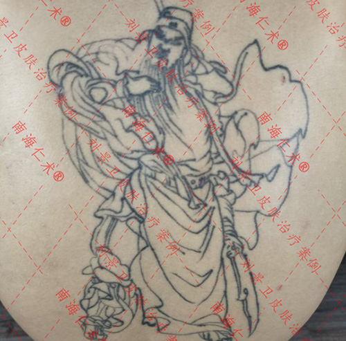 苏庆荣洗纹身.jpg