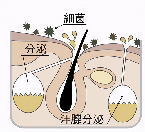 狐臭.png