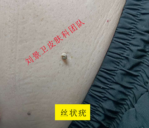 d61556555ca4cf3f4bd95af1e93a964.jpg