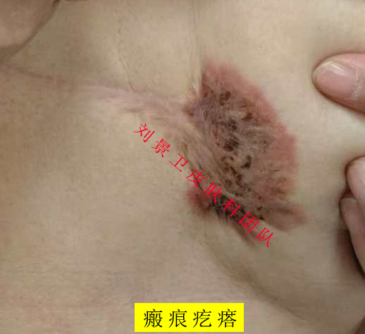 iwElAqNqcGcDAQTRBQAF0QUABrA1c9BVFNpBJgf7oN5Ua_8AB9MAAAAAoPg_BggACaVqc2FwaQoAC9IAARny.jpg_720x720q90.jpg