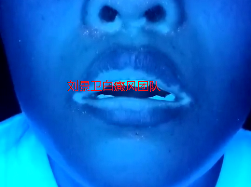 4124481ca090de2221e493c138c9990f.png